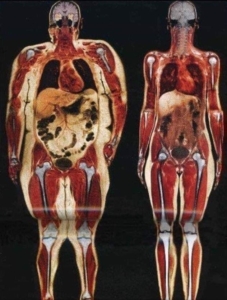 Body Fat Comparison